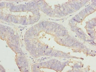 Polyclonal Rabbit anti-Human RABGEF1 Antibody (aa1-491)
