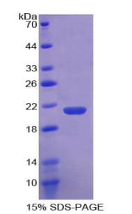 Human F2 / Prothrombin / Thrombin Protein (Recombinant His-T7)