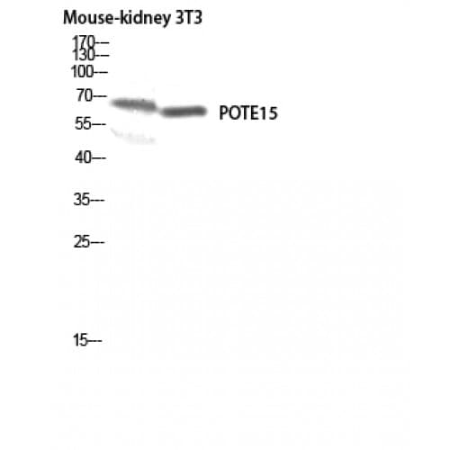 POTEB3 / POTE-15 Antibody (450-530 aa, C-terminal)
