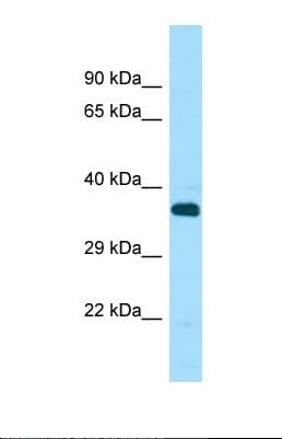 Polyclonal Rabbit anti-Human STK33 Antibody (aa393-442, WB)