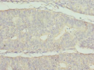 FRK Antibody