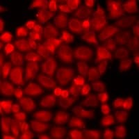 KIAA1456 / C8orf79 Antibody