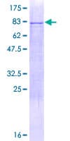 Human KRT79 / Keratin 79 Protein (Recombinant GST)