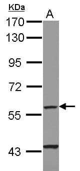 Polyclonal Rabbit anti-Human CYP4F11 Antibody (WB)