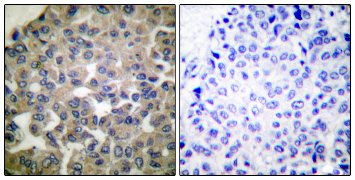 PLCG1 Antibody (aa736-785)