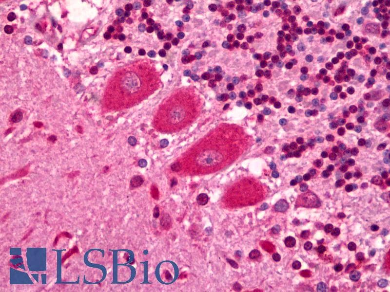 IHC-plus™ Polyclonal Rabbit anti-Human ITPR1 / IP3 Receptor Type 1 Antibody (N-Terminus, IHC, WB)