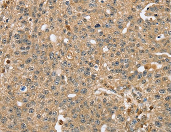RNH1 Antibody