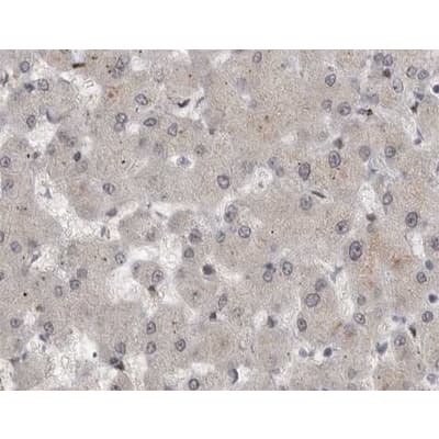 MAP2K1 / MKK1 / MEK1 Antibody (phospho-Ser221)