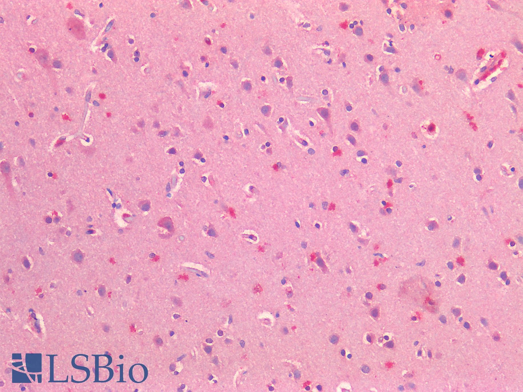 IHC-plus™ NOTCH2 Antibody