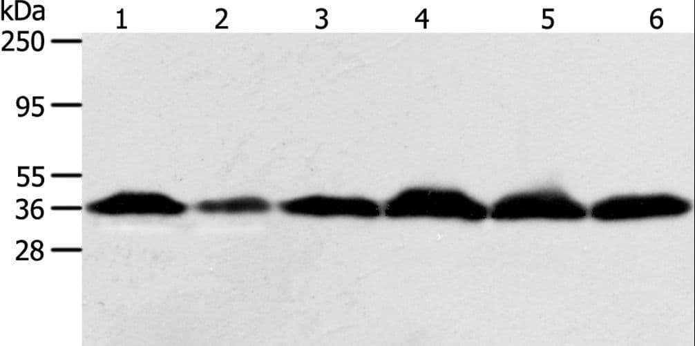 Polyclonal Rabbit anti-Human APEX1 / APE1 Antibody (IHC, WB)