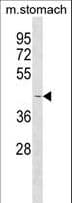 Polyclonal Rabbit anti-Human COLQ Antibody (aa324-353, WB)