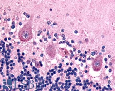 IHC-plus™ Polyclonal Rabbit anti-Human ADGRB1 / BAI1 Antibody (C-Terminus, IHC)