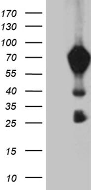 Monoclonal Mouse anti-Human MBD1 Antibody (clone OTI2D7, aa222-556, WB)