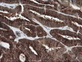 Monoclonal Mouse anti-Human PIK3CG / PI3K Gamma Antibody (clone OTI2B1, IHC, WB)