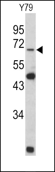 LMNB2 / Lamin B2 Antibody (aa476-504)