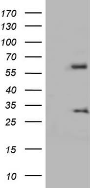 KLHL12 Antibody (aa177-405, clone OTI4C10)