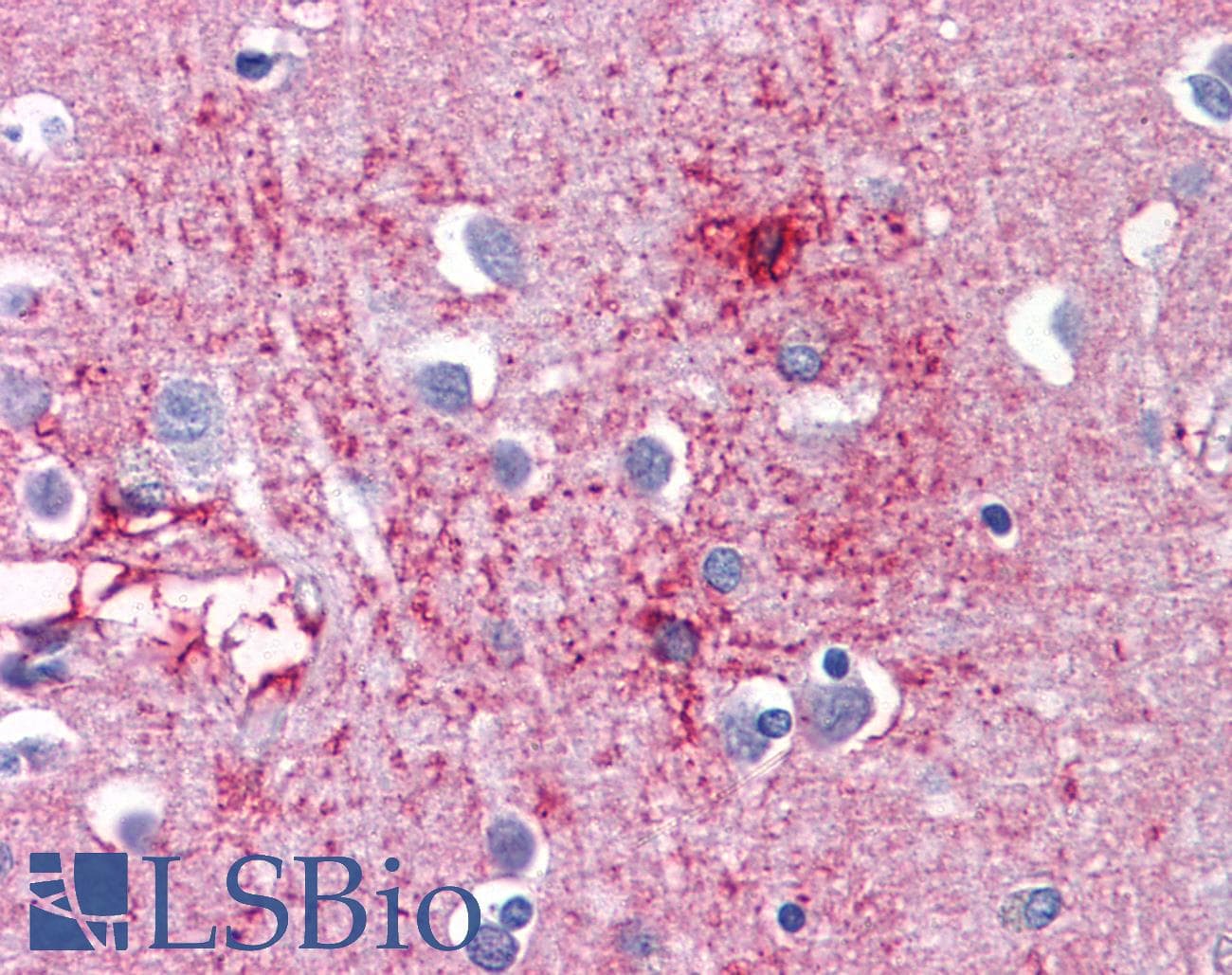 IHC-plus™ Monoclonal Mouse anti-Human CDH18 / Ey-Cadherin Antibody (clone 6F7, IHC, WB)