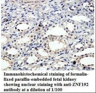ZNF192 Antibody (aa169-383)