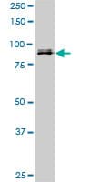IHC-plus™ SP1 Antibody (clone 1A5)