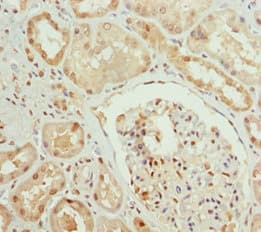 PPP1R8 / Rnase E Antibody