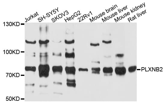 PLXNB2 / Plexin B2 Antibody