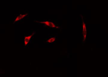 DMTN / Dematin Antibody (phospho-Ser403)