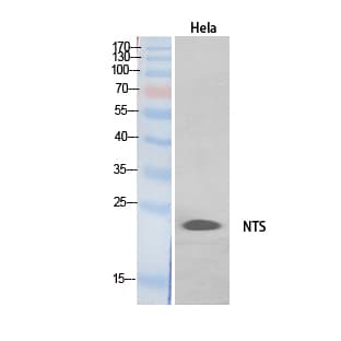 Polyclonal Rabbit anti-Human NTS / NT / Neurotensin Antibody (WB)