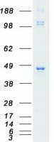 Human PDK2 Protein (Recombinant Myc-DDK (Flag))