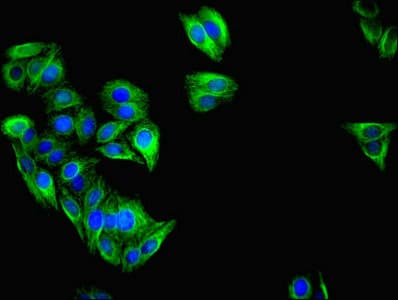 IHC-plus™ IFIT3 Antibody (aa1-490)