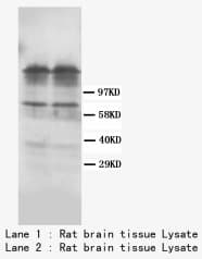 DRD1 / Dopamine Receptor D1 Antibody (C-Terminus)