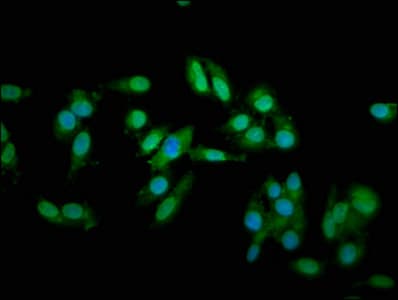 Polyclonal Rabbit anti-Human TNNT2 / CTNT Antibody (WB)
