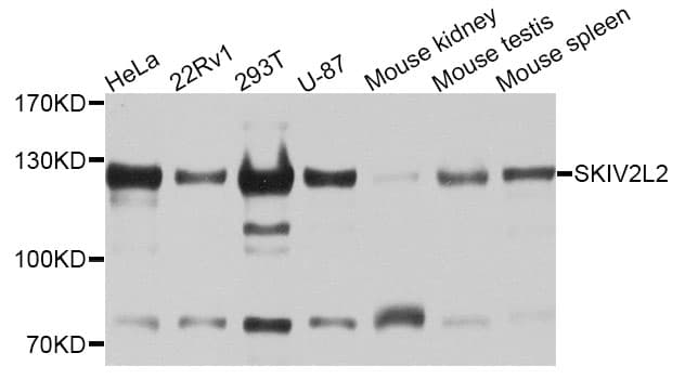 IHC-plus™ Polyclonal Rabbit anti-Human SKIV2L2 Antibody (IHC, WB)