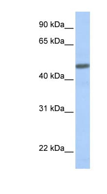 CALCRL / CGRP Receptor Antibody (aa108-157)