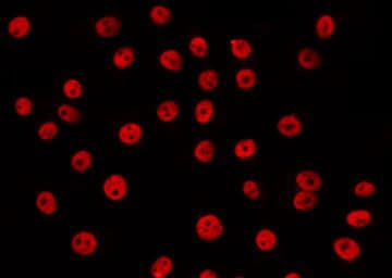 Polyclonal Rabbit anti-Human RCBTB1 Antibody (IHC, IF, WB)