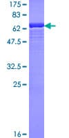 Human SMS / Spermine Synthase Protein (Recombinant GST)