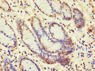Polyclonal Rabbit anti-Human SBF2 Antibody (IHC, IF)