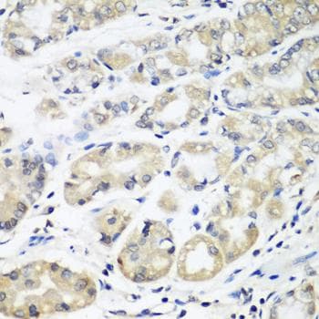 Polyclonal Rabbit anti-Human HLA-DMB Antibody (IHC)