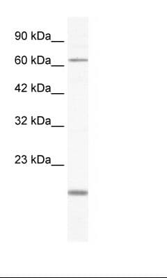 TBX5 Antibody (aa174-223)