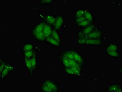 PVALB / Parvalbumin Antibody (aa2-110)