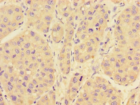 RAB28 Antibody (aa98-218)