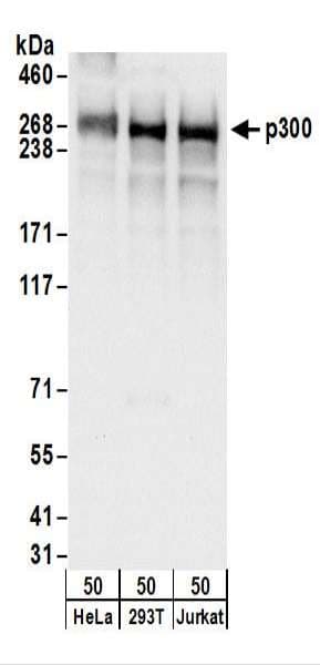 Polyclonal Rabbit anti-Human EP300 / p300 Antibody (aa950-1000, IHC, WB)