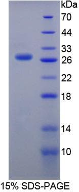 Human USAG1 / SOSTDC1 Protein (Recombinant His-T7)