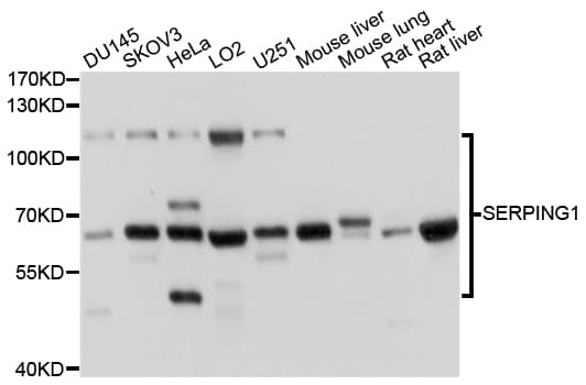 SERPING1 / C1 Inhibitor Antibody