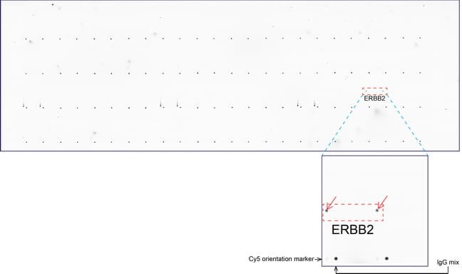 ERBB2 / HER2 Antibody (aa676-1255, clone UMAB34)