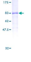 Human PPP5C Protein (Recombinant GST)
