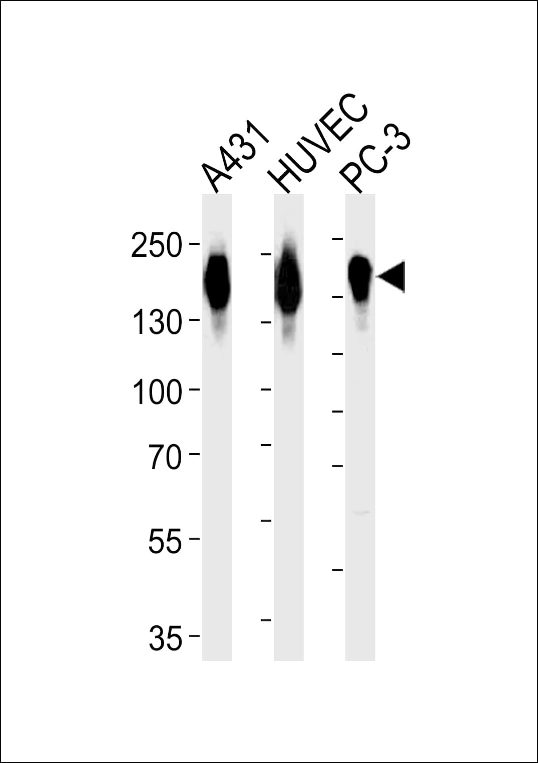 EGFR Antibody (aa1004-1033)