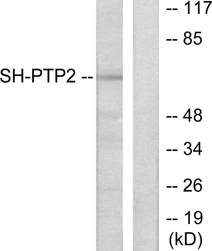 IHC-plus™ PTPN11 / SHP-2 / NS1 Antibody (aa321-370)