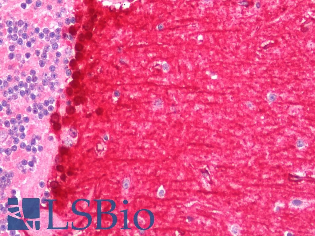 IHC-plus™ PYCARD / ASC / TMS1 Antibody