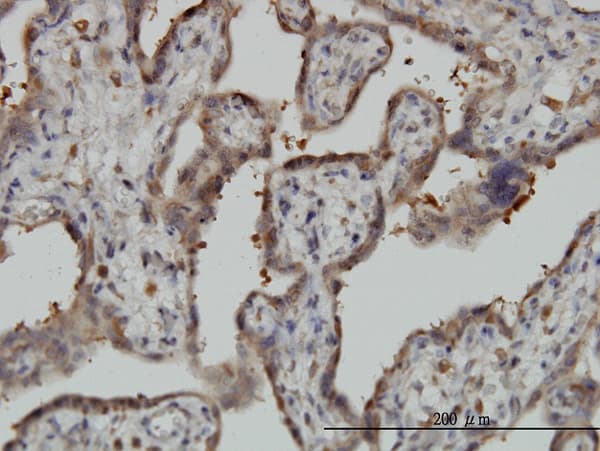Monoclonal Mouse anti-Human NT5C2 Antibody (clone 3C1, IHC, IF, WB)