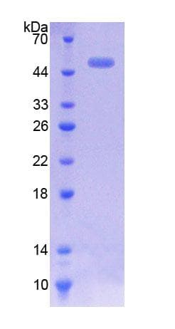 Mouse CACNA1H / Cav3.2 Protein (Recombinant His-GST)